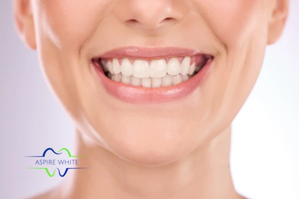 Follow your teeth whitening aftercare Southampton to prolong your whiter smile!