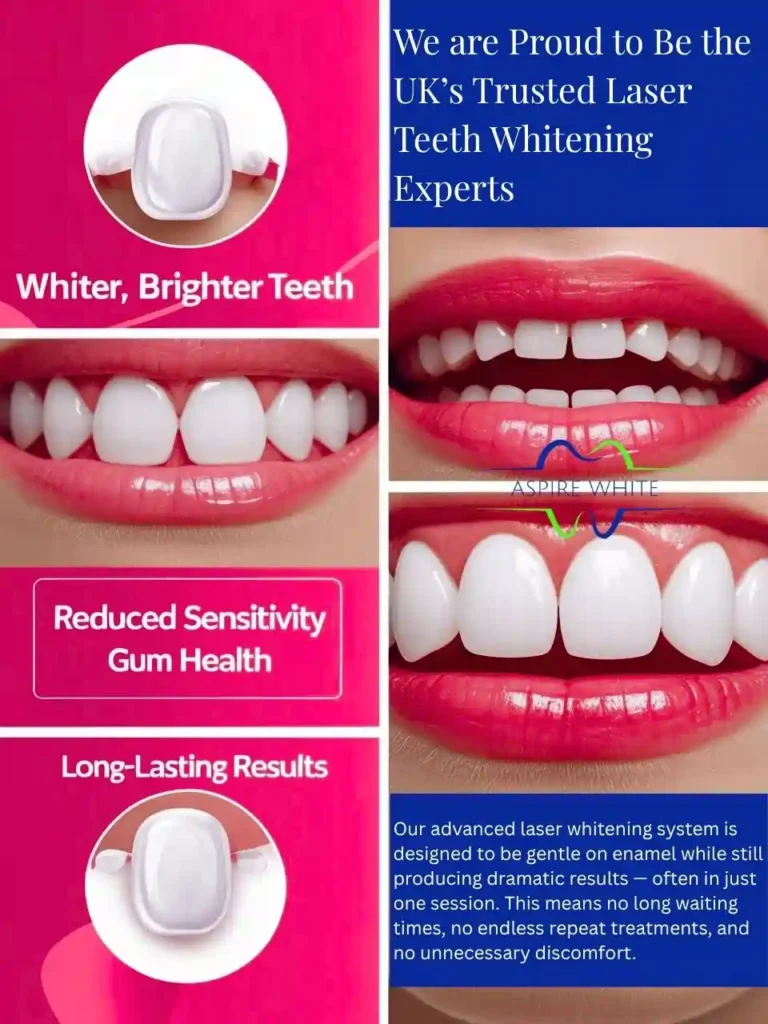 We are Proud to Be the UK’s Trusted Laser Teeth Whitening Experts Southampton
